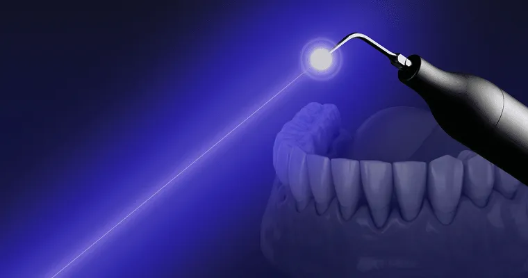 光で歯周病菌を除去する体に優しい歯周病治療 Periodontal Treatment