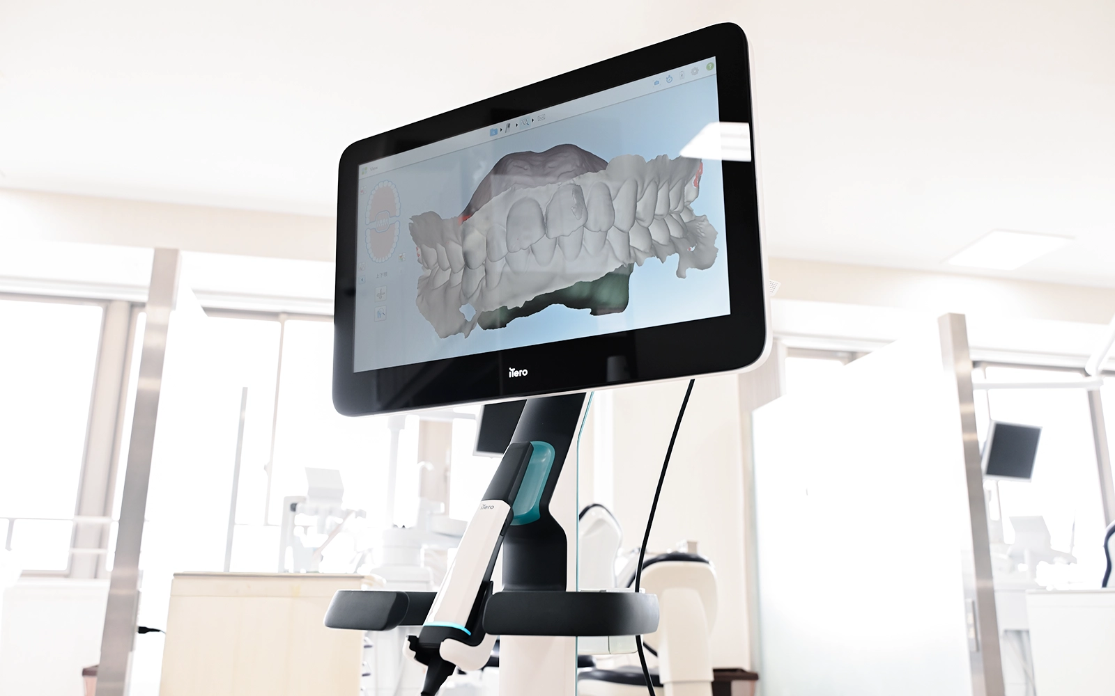 iTero