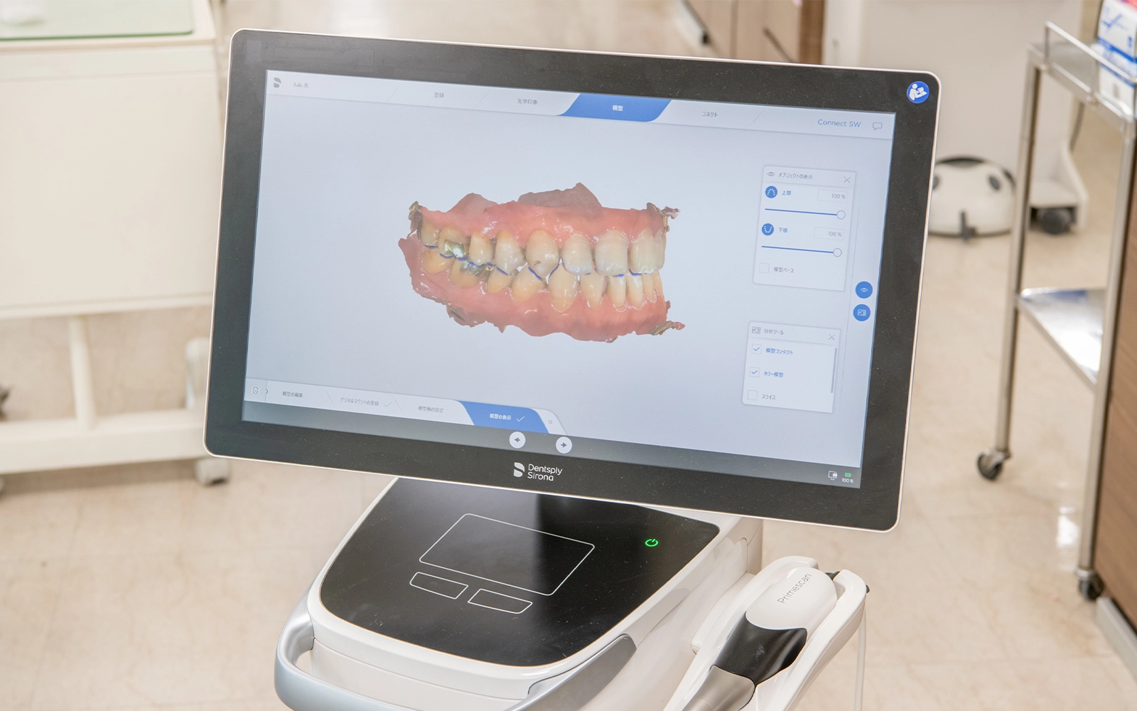 口腔内スキャナー