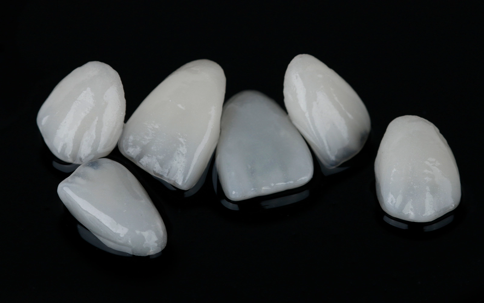 ラミネートベニア