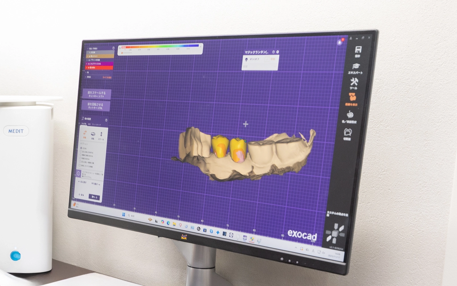 補綴専門医・外科医・歯科技工士のチーム体制