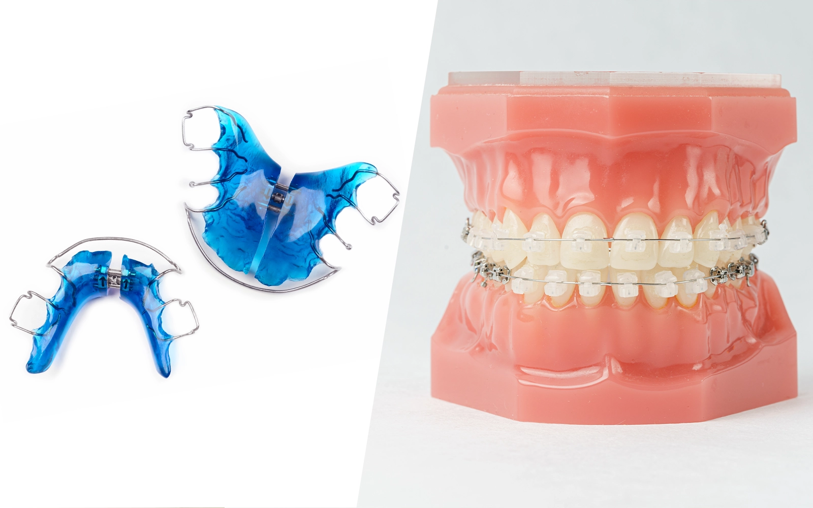 従来の小児矯正との違い