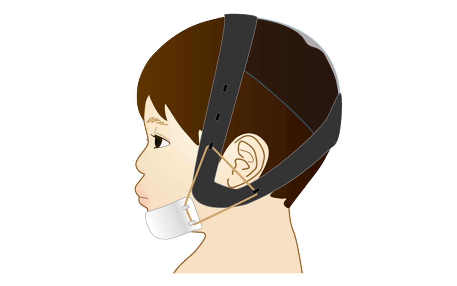 ヘッドギア・チンキャップ