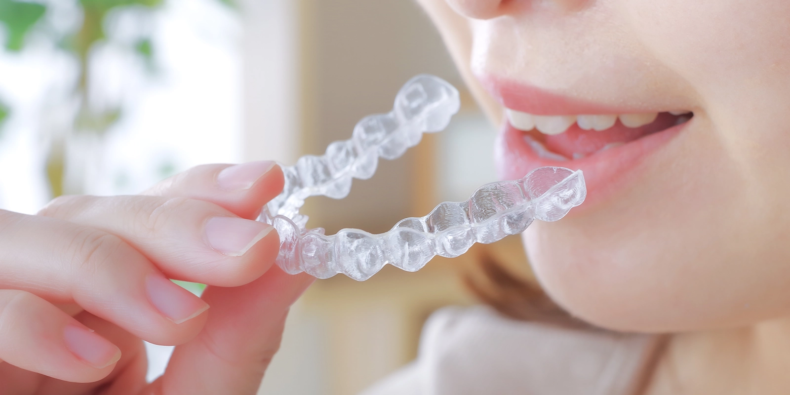 マウスピース矯正とは