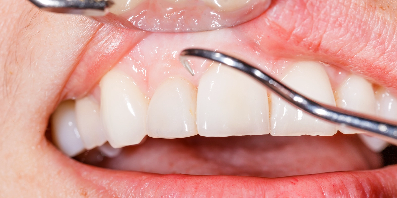 段階ごとに「今必要な処置」を見極める当院の治療体制