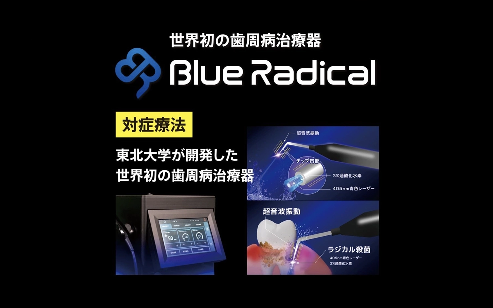 器具が届かない深部の細菌を光触媒で除菌する