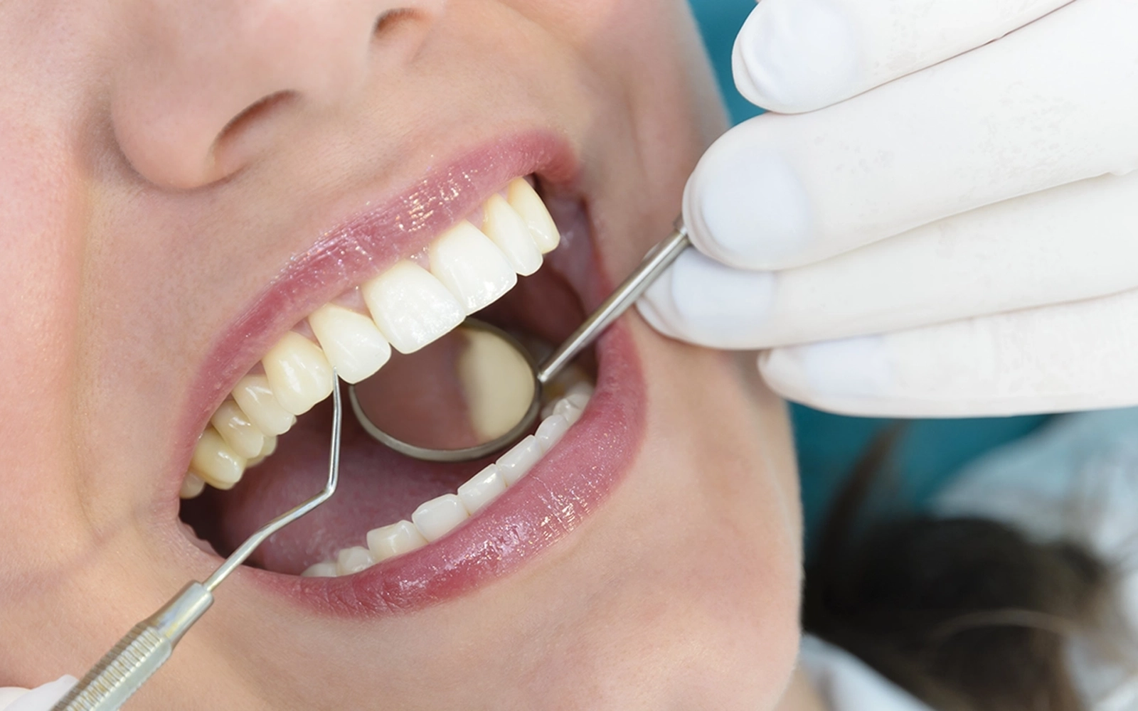 歯周病専門医監修予防メンテナンス