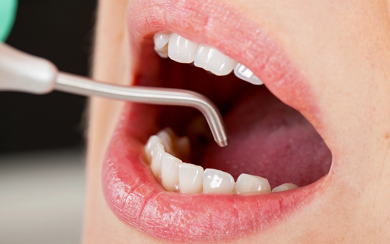 歯周病専門医監修予防メンテナンス