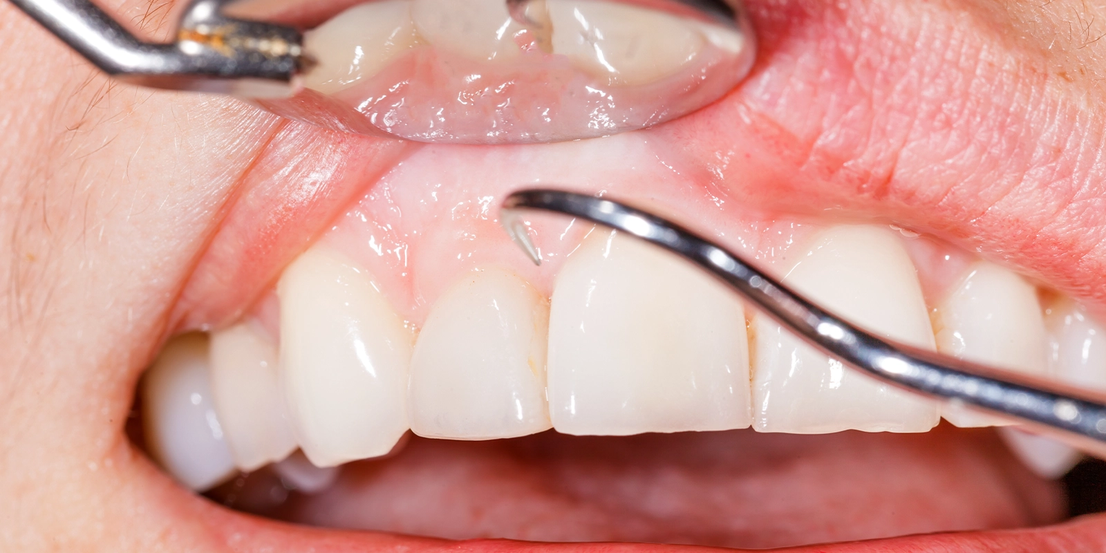 必要最小限のスケーリング