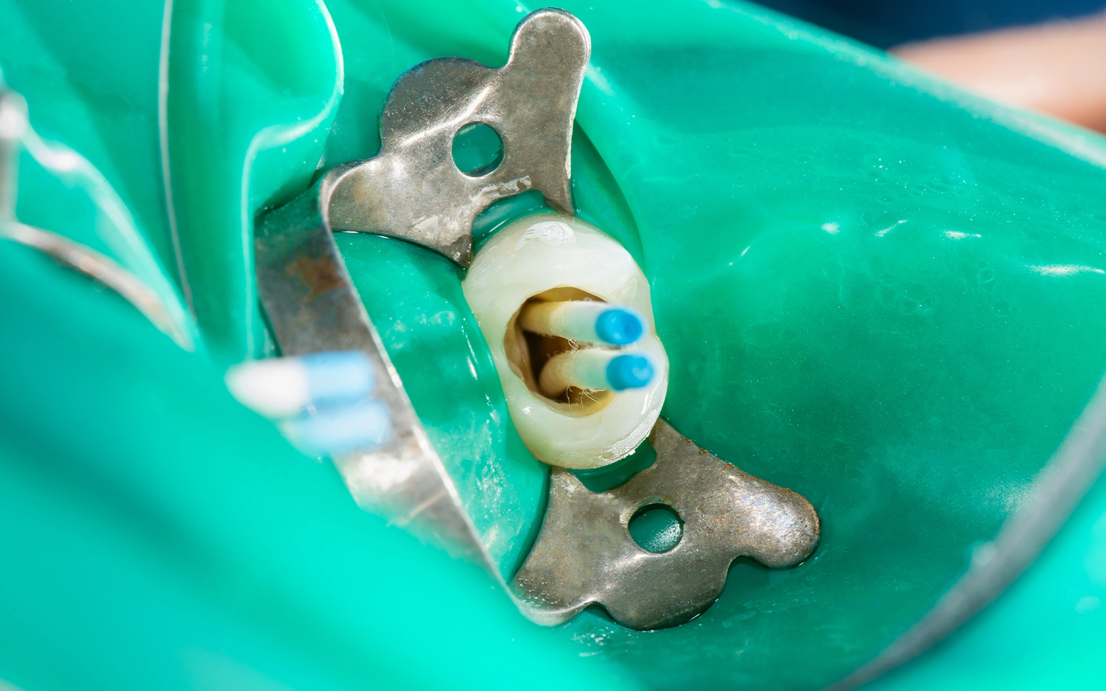 無菌状態の維持