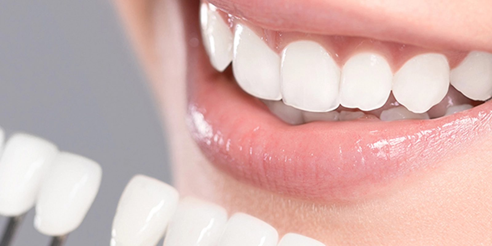 ホワイトニングとは