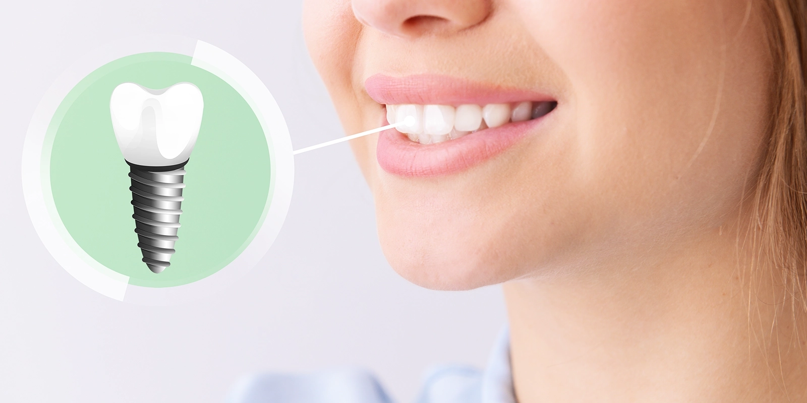 被せ物や詰め物がある方への対応